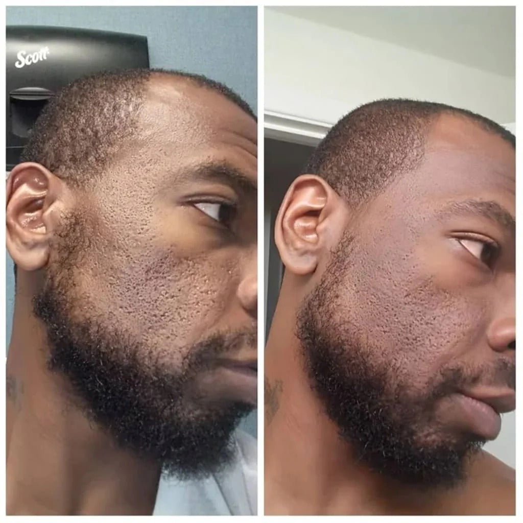 Glass Skin Essential Kit (5 pcs)